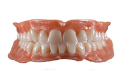 CUSTOMIZED ABUTMENT