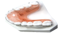 METAL CERAMIC