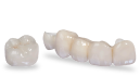ZIRCONIA